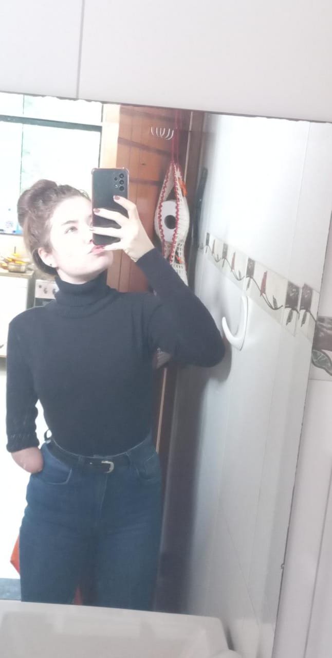 Marina_amputee #xomqKjiW